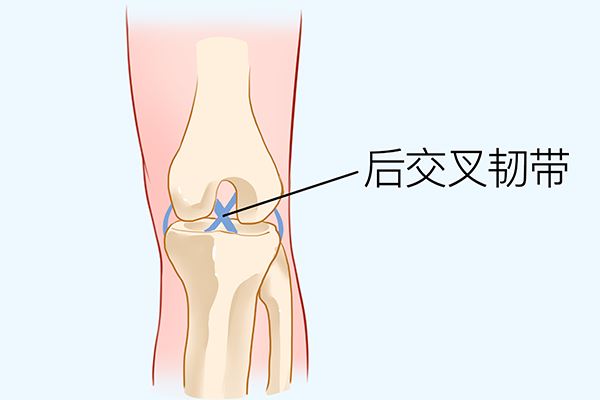 膝关节置换术后如何康复