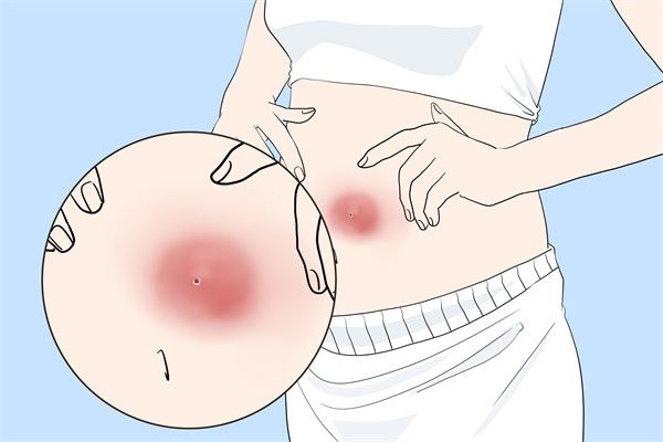 六个月大的宝宝咳嗽快速治疗方法